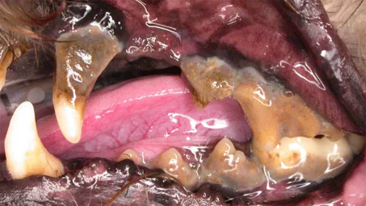 Stage 4 periodontal disease. Local disease is obvious, with profound tartar accumulation, gingival recession, and purulent debris and plaque present in the sulcus.